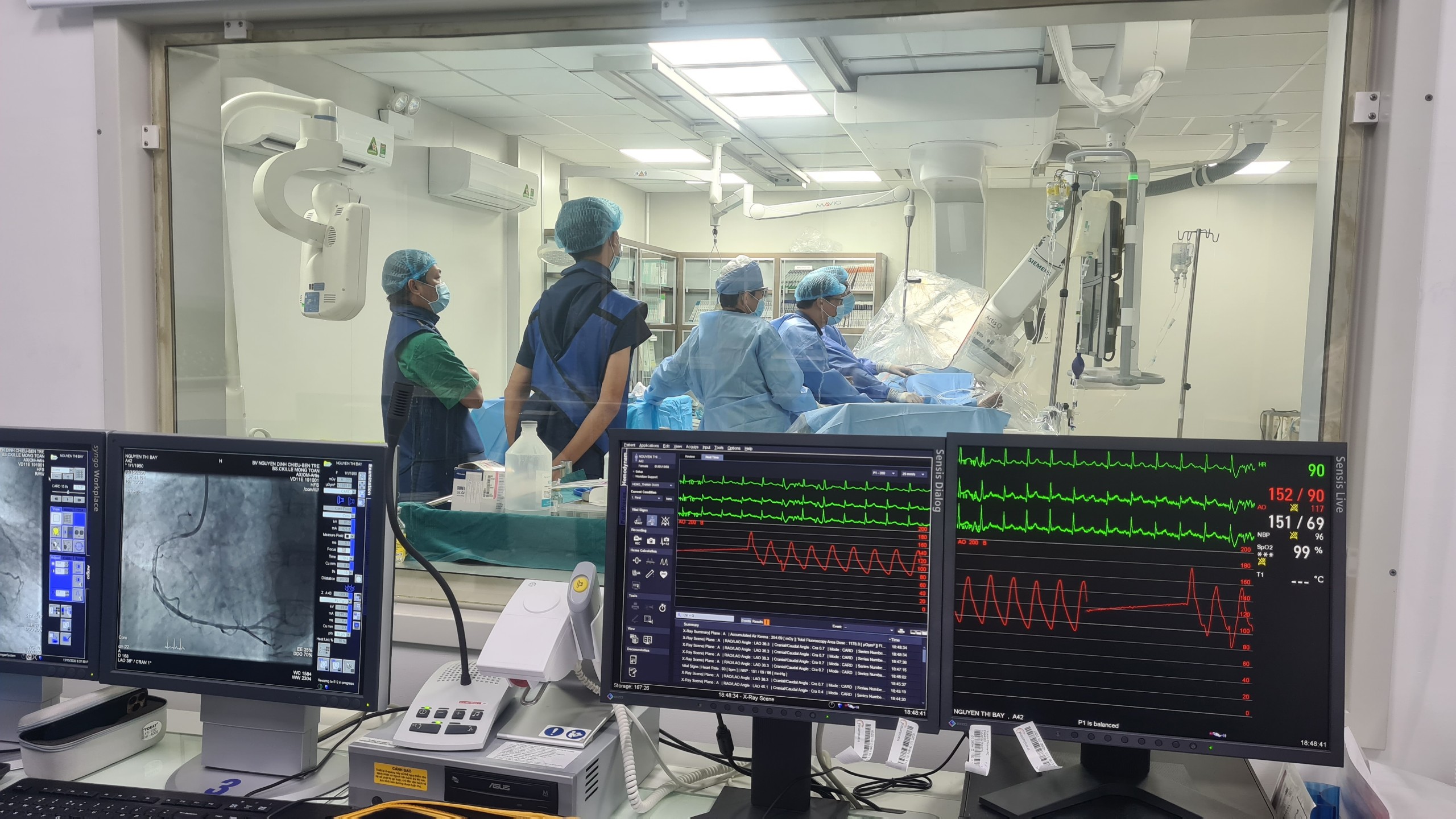Bệnh viện Nguyễn Đình Chiểu cấp cứu thành công một ca bị nhồi máu cơ tim cấp